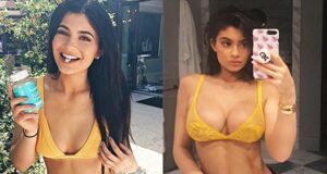 Louisville or LA? Kylie Jenner’s Plastic Surgeon Gives Best Boob Job