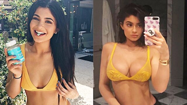 Louisville or LA? Kylie Jenner’s Plastic Surgeon Gives Best Boob Job