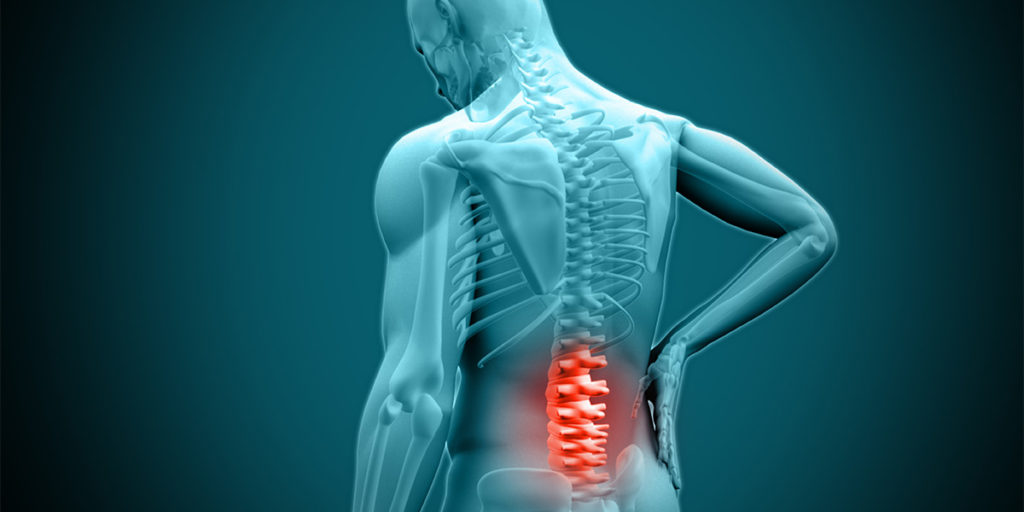 What Is A Herniated Disc? Symptoms, Causes And Treatment Atlanta Celebrity News